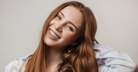 Braces